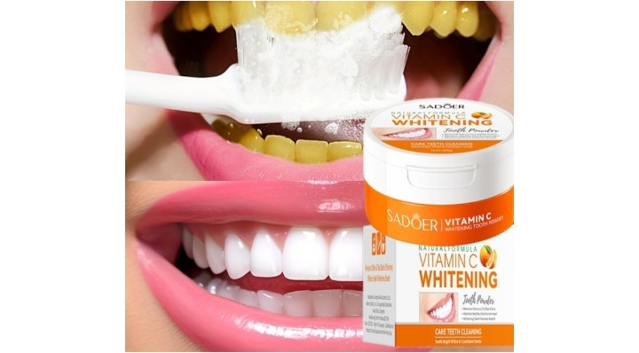 سفید کننده دندان ویتامین سی