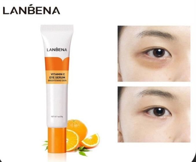 دورچشم اصلی لانبنا