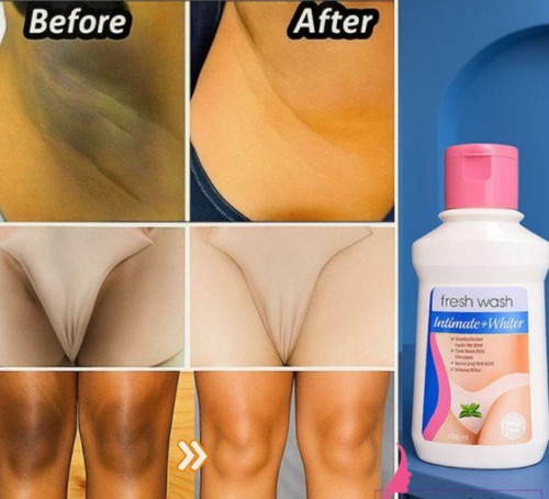 کرم سفید کننده وکالی گلوتاتیون 👌 اصلی اورجینال 💯