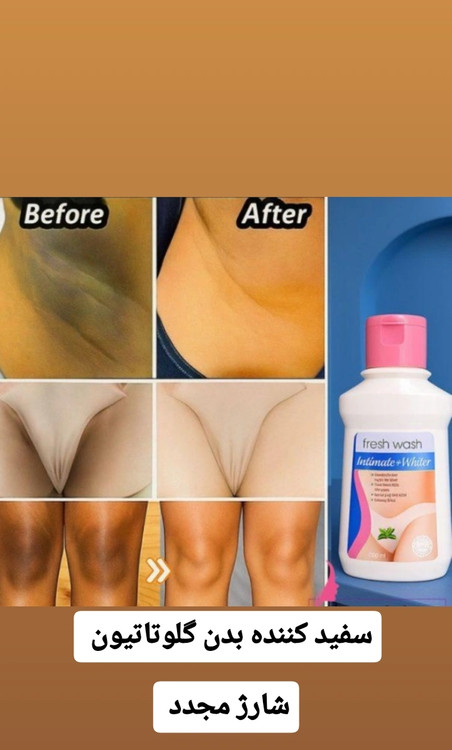 روشن کننده دایمی پوست و رفع تیرگی نقاط حساس بکینی و زیر بغل