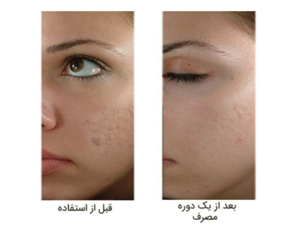 آبرسانی و جوانی و شادابی پوست