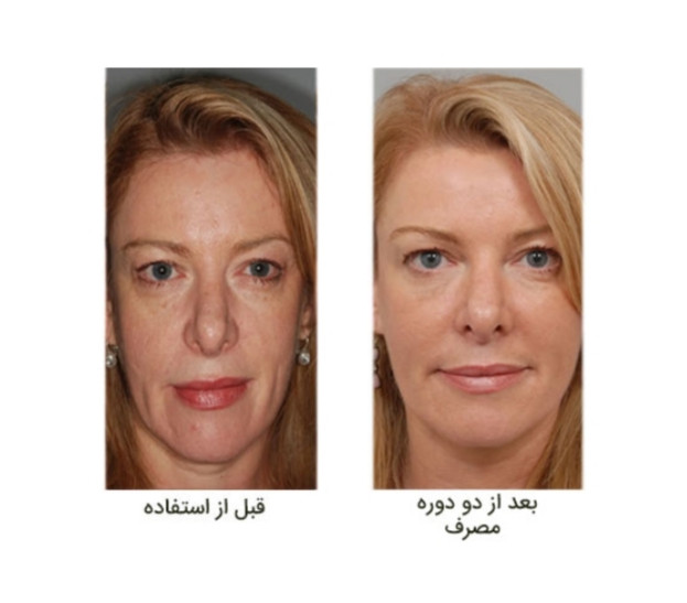 جوانسازی پوست و مو