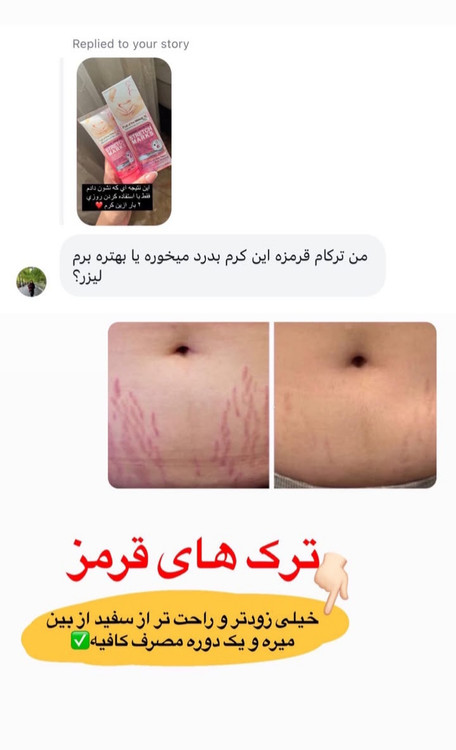 ترک های قرمز زودتر میره و ترک های سفید دوره مصرف طولانی ترداره