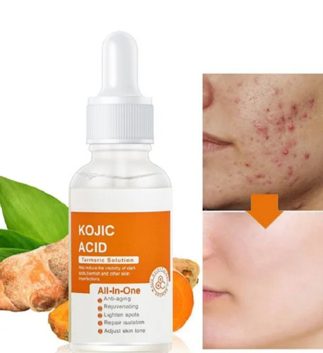 سرم ضدلک و روشنکننده کوجیک اسید مویام