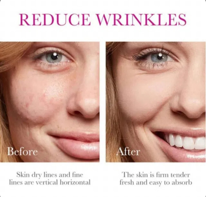 حاوی کلاژن و عصاره حلزون تسکین دهنده پوست