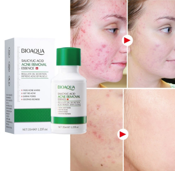 سرم ضد جوش و کوچک کننده منافذ بیوآکوا حاوی سالیسیلیک اسید