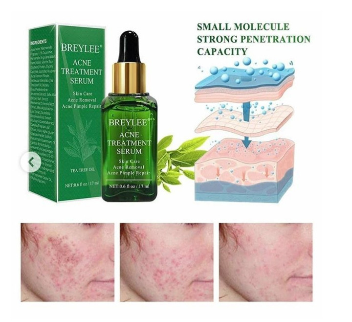 بستن منافذ باز پوست ترمیم بافت آسیب دیده پوست