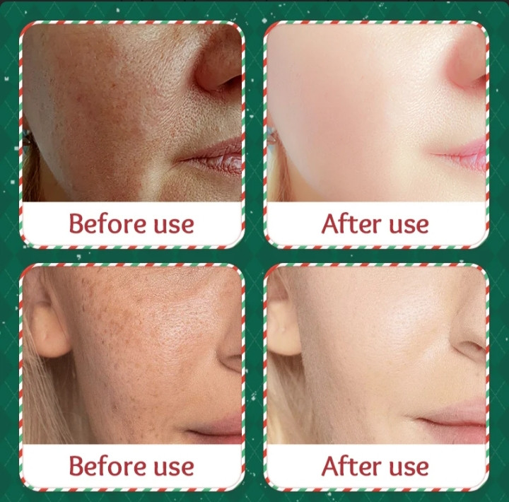 نیاسینامید: کمک به یکنواخت شدن رنگ پوست و افزایش شفافیت