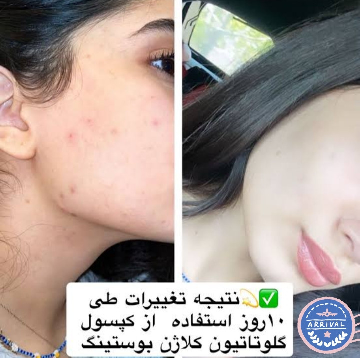 کپسول کلاژن برند بوستینگ