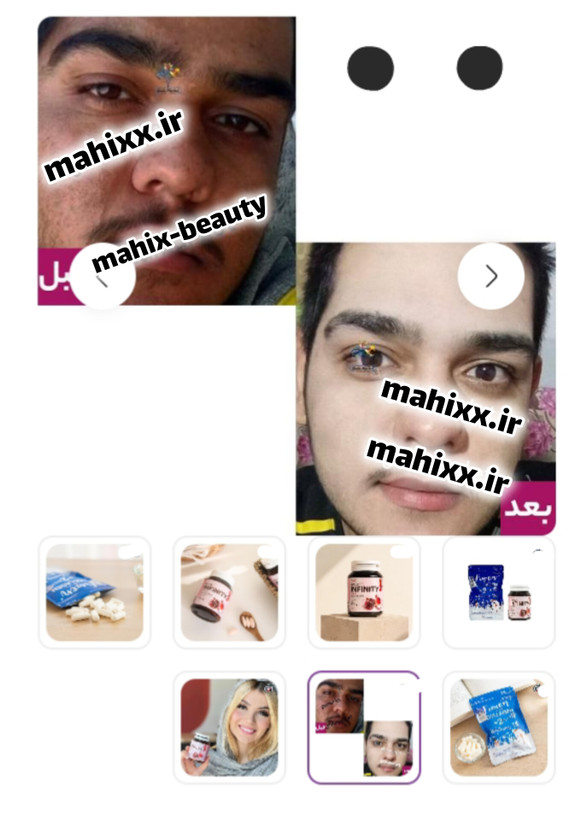 پک تخفیفی سفیدی ضدجوش (اینفینیتی+منجمد)
